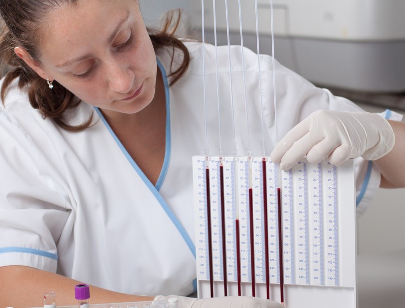 Mit jelent We vérsejtsüllyedés érték laborlelet