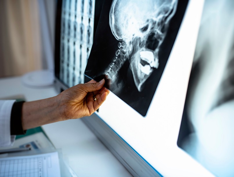 kórház per elveszít koponya