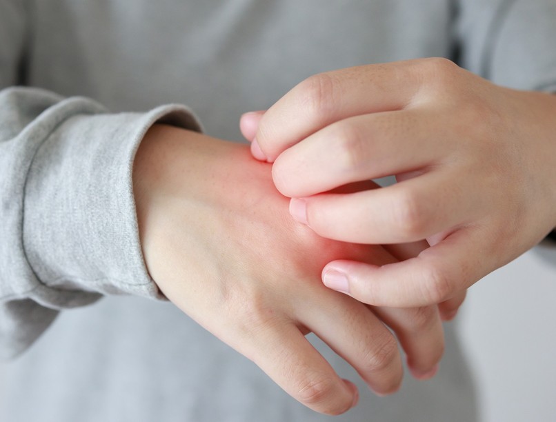 viszketés, bőrszárazság, tél, kezelés