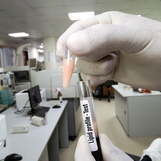 Felborult a lipidprofilja? Ezzel a 8 egyszerű lépéssel fellélegezhetnek az erei című cikk nyitóképe