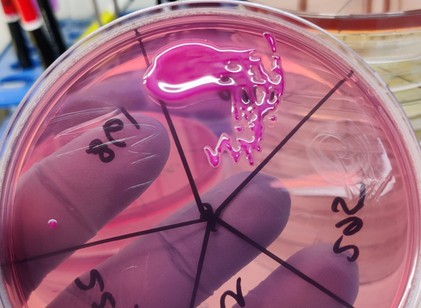 Fertőzés a koraszülött intenzíven: időben kiszűrték a Klebsiella-baktériumot szegediek című cikk nyitóképe