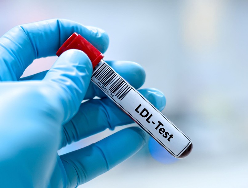 LDL-koleszterin magas koleszterin szívbetegség új irányelv