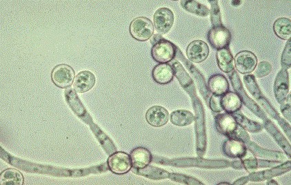 Candida-fertőzés, mint figyelmeztető jel