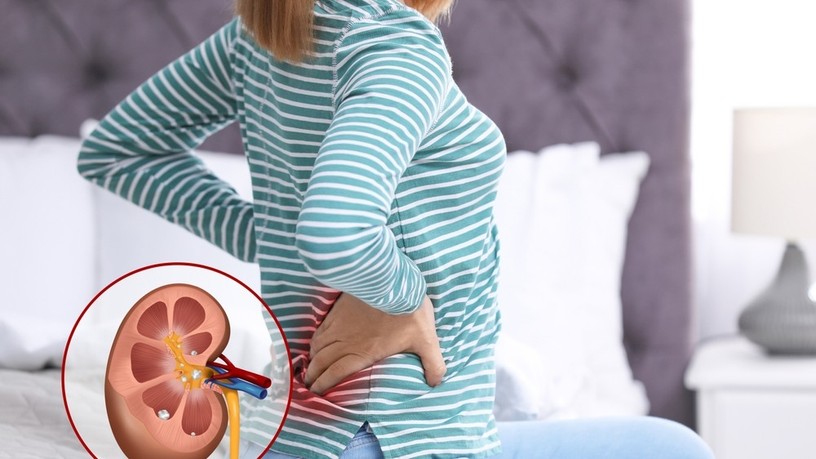vesebetegség, CKD, idült vesebetegség, vesefunkció