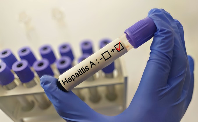 Nem csitul a hepatitis A fertőzés az országban című cikk nyitóképe