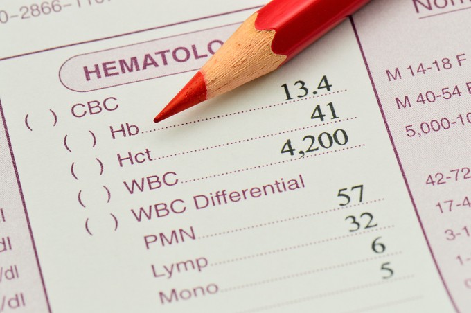 Mit jelent a hematokrit (Htc) érték a laborleleten? című cikk nyitóképe