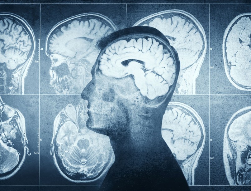 szokás agy öregedés gyorsít kutatás