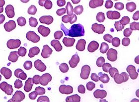 Betegségek kapcsolata: mi mindenre kellene gondolni...