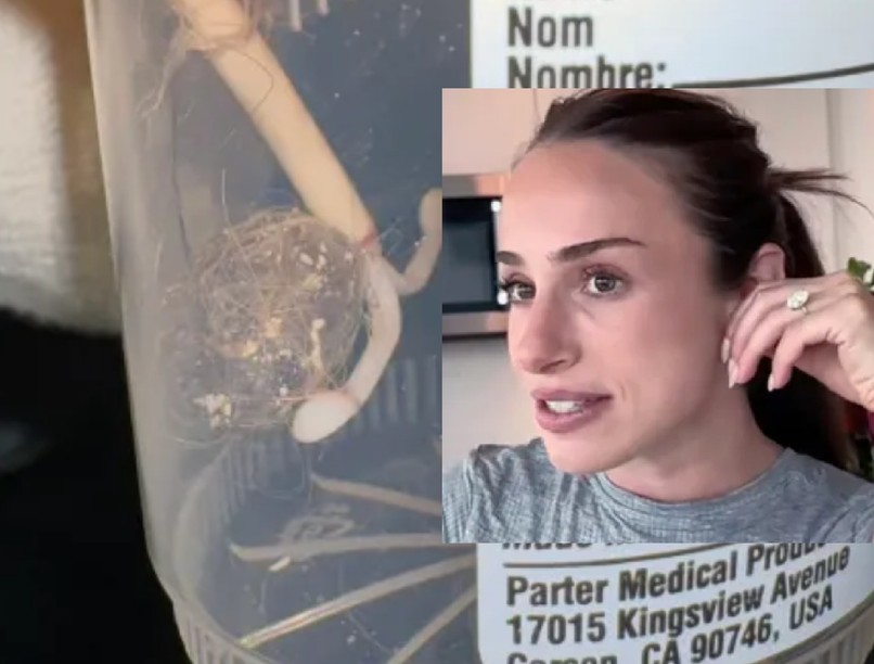 spirál köré tekeredett szőr