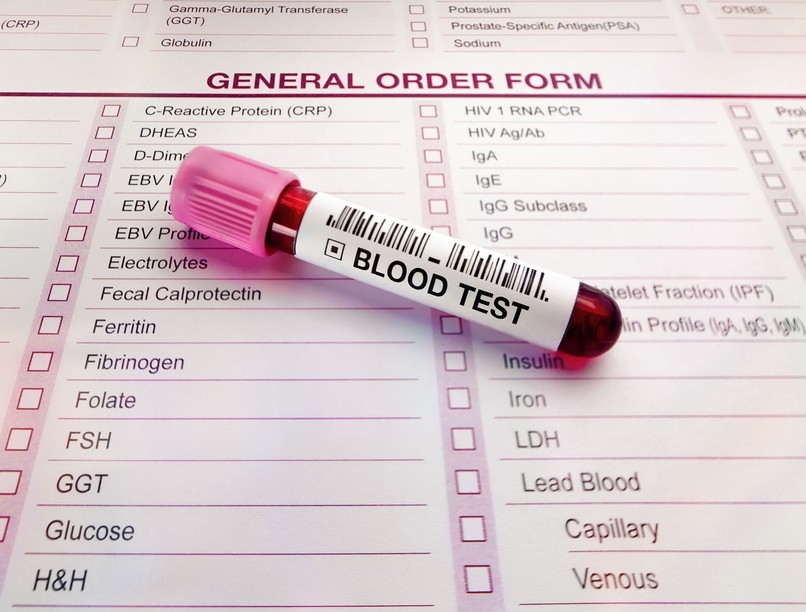 vastagbélrák tünet labor vérszegénység diagnózis