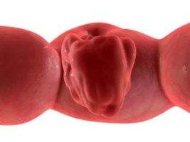 Fontos! A leggyakoribb rákkeltő anyagok listája