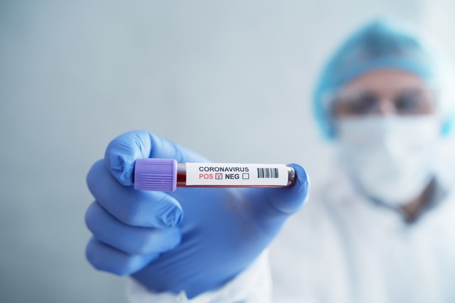 Mától újabb magánkórház végez koronavírus-tesztet