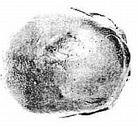 Szent István ünnepére: ősi magyar gyógymódokról