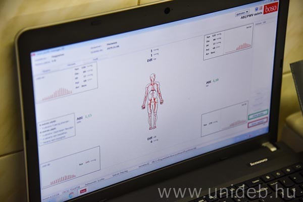 A vizsgálat ingyenes