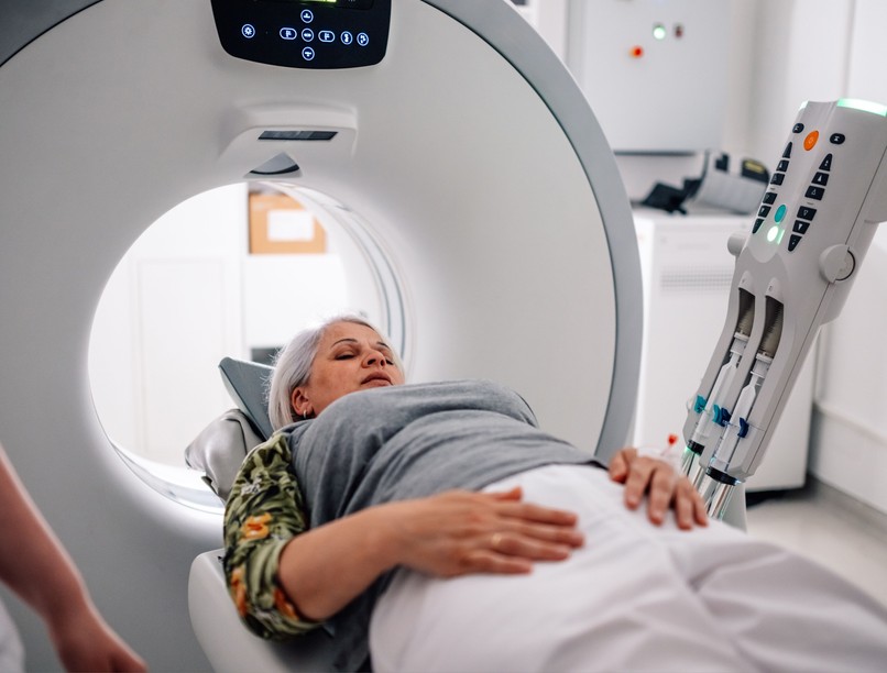 orvostudományi kutatások CT vizsgálat rák veszély