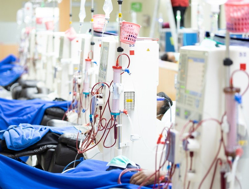 dialízis vértisztítás, hemodialízis peritoneális dialízis kezelés leírás