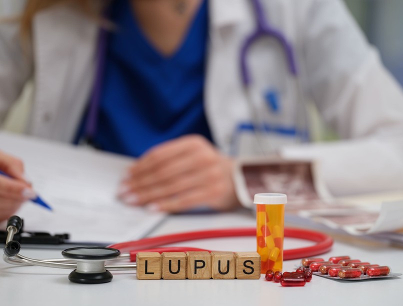 lupus tünet diagnózis arcpír ízületi fájdalom