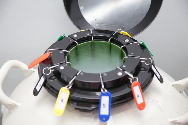 Mínusz 196 Celsius-fokos remény: új eljárás segíti a rákbeteg gyerekek későbbi gyermekvállalását