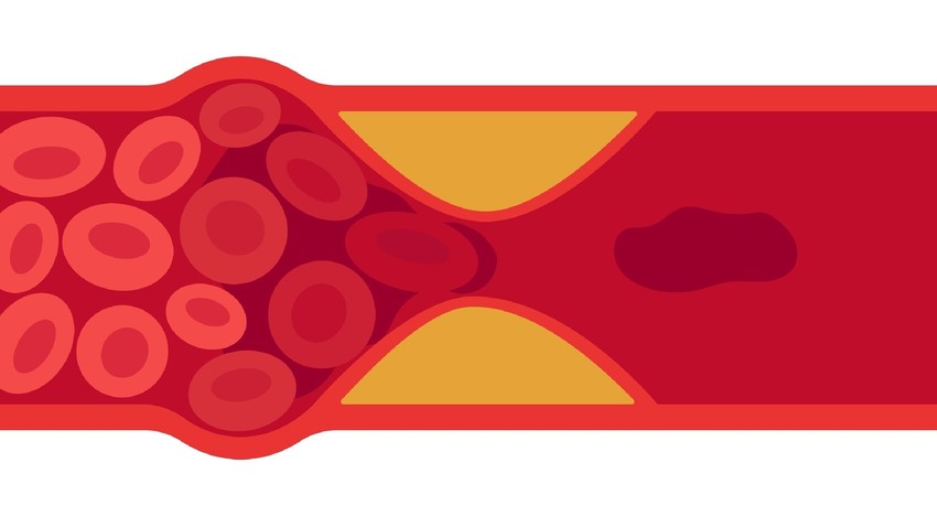 Ha ezeket a tüneteket tapasztalja, sürgősen forduljon orvoshoz!