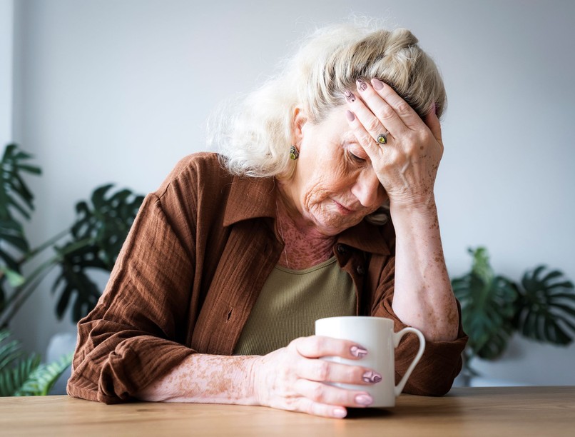 stroke után nem ismeri fel a szeretteit a beteg