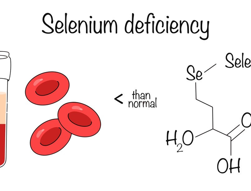 Szelénhiány tünet vizsgálatkezelés