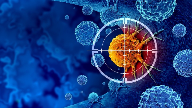 prosztatarák, prosztata daganat, tumor diagnózis, szűrővizsgálat