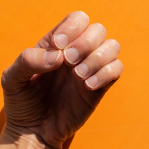 Egy sötét csík, egy furcsa forma – 5 jel, amikor a körmök daganatra figyelmeztetnek című cikk nyitóképe