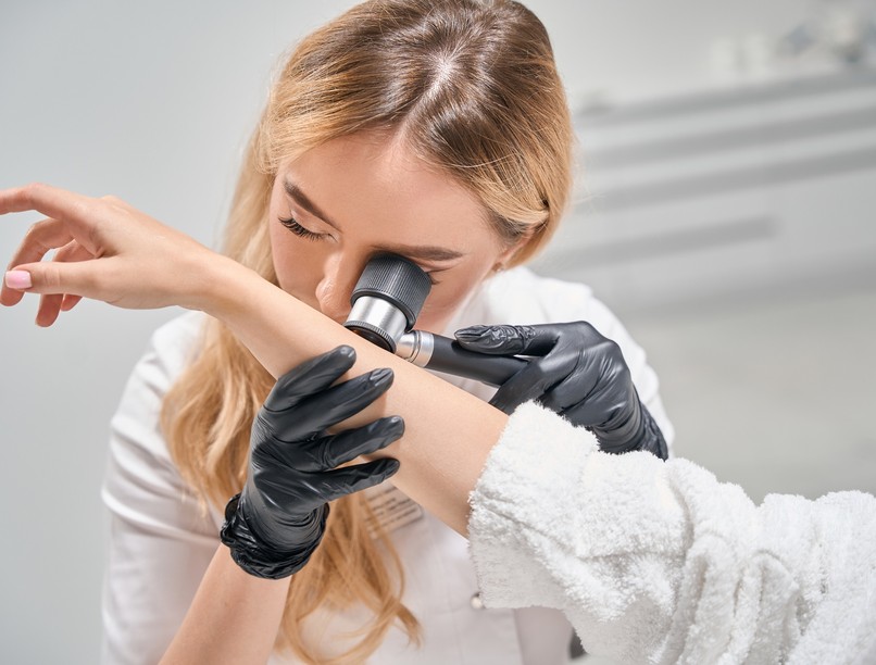 anyajegy bőrrák melanóma bőelváltozás tünet