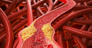 Magas koleszterinszint ellen mit együnk és mit ne? Dietetikus mondja el, mit kerüljön