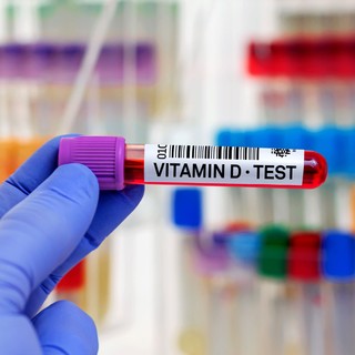 D-vitamin szint: kockázatot jelent, ha nincs legalább ennyi a szervezetben című cikk nyitóképe