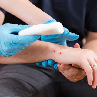 Kígyómarás, kígyóharapás tünetei, vizsgálata és kezelése című cikk nyitóképe