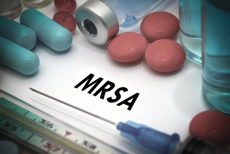 MRSA-fertőzés: tünetei, vizsgálata és kezelési lehetőségei