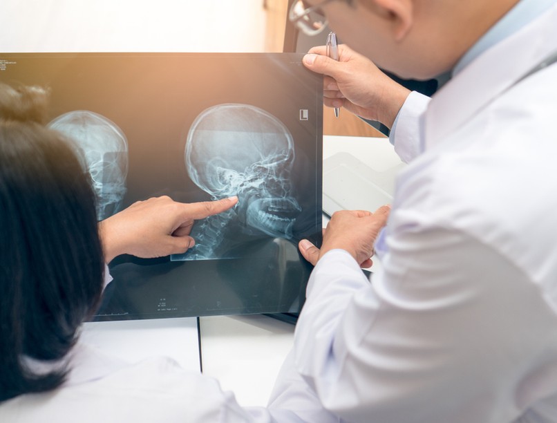 fej-nyaki daganatok, rák, tünetei, diagnózis, fül- orr-gégészet