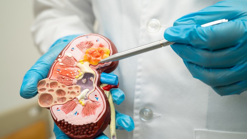 Wilms-tumor oka tünet kezelés