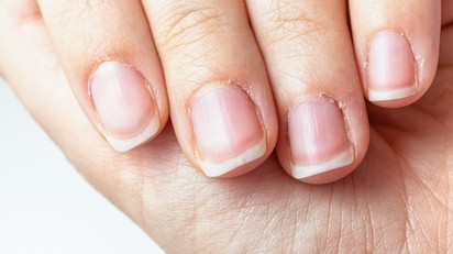 Berepedezik a körömágya? Így ápolja a bőrét, hogy megelőzze a fájdalmat  című cikk nyitóképe