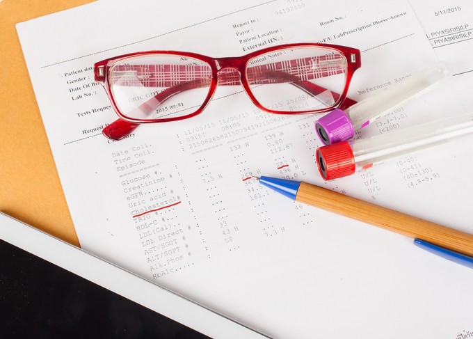 Miért lehet magas a HDL-koleszterin szintje – és kell-e aggódnia miatta? című cikk nyitóképe