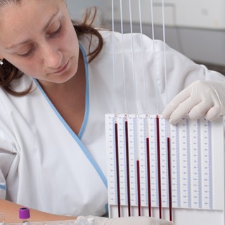 Mit jelent a We (vérsejtsüllyedés) érték a laborleleten? című cikk nyitóképe