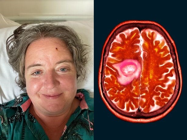 Félrediagnosztizálták, majd kiderült, csak 18 hónapja maradt az életből az anyának