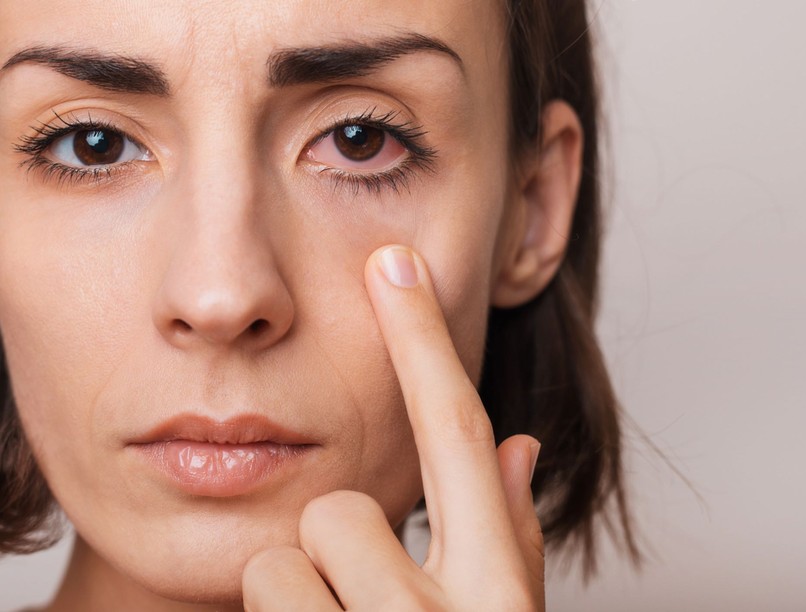 viszketés bal szem mit jelent