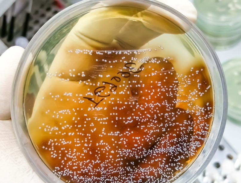 rák, daganat, gomba, mikrobiom, candida, kutatás