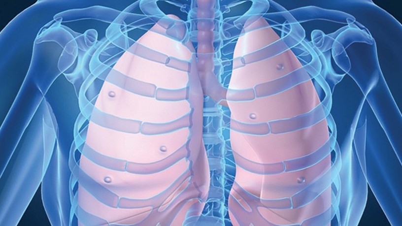 chest_medicine_board