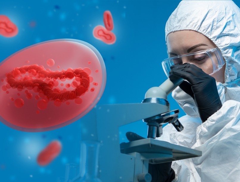 majomhimlő, majomhimlő tünetei, végbélfájdalom, pénisz duzzanat, fertőző betegség, vírus