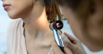  Mikor kell levenni egy anyajegyet, és miről lehet felismerni, hogy gond van? 