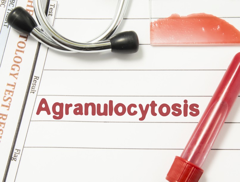 Agranulocitózis tünet vizsgálat kezelése