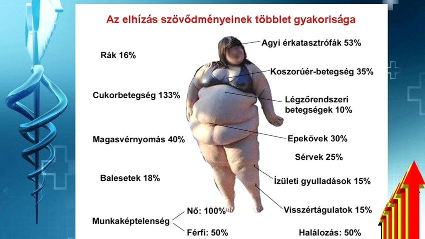 Az elhízás szövődményeinek többletgyakorisága