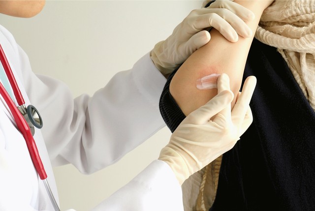 Ezért tér vissza állandóan az ekcéma a bőrgyógyász szerint