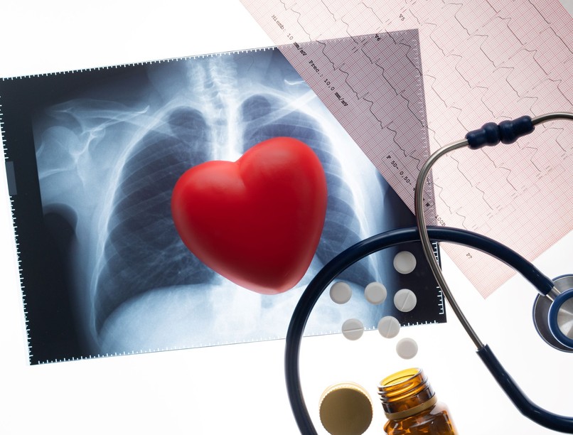 gyógyszeres kezelés Béta-blokkoló meddig kell szedni