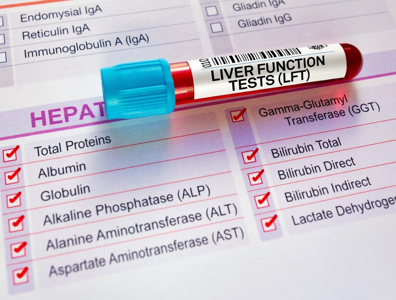 GGT érték csökkentése hogyan