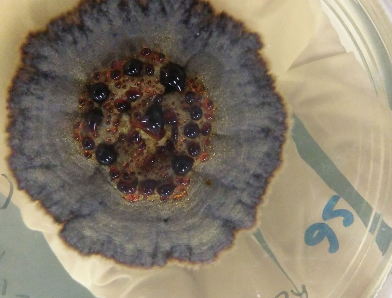 bőrgomba, gombás fertőzés jelei, tünetei, kezelése