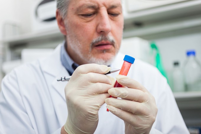 Bajt jelent, ha ezt kimutatják a vérben: a tudósok egy korai Parkinson-kór jelet találtak című cikk nyitóképe